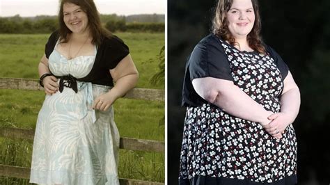 Woman Who Had £9000 Op To Help Lose Weight Needs £11000 Surgery After Ballooning Again