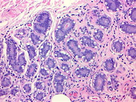 Pathology Outlines Histology