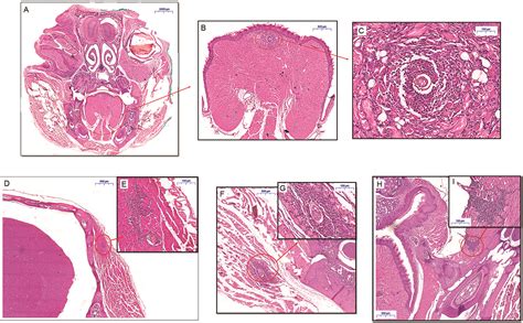 Scielo Brasil Schistosoma Mansoni Granulomas In The Skeletal