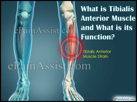 Tibialis Anterior Muscle Straincausessymptomstreatment