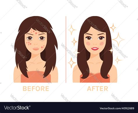 Beautiful Brunette Woman And Ugly Royalty Free Vector Image