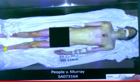 Whats The Deal Michael Jacksons Autopsy Photo