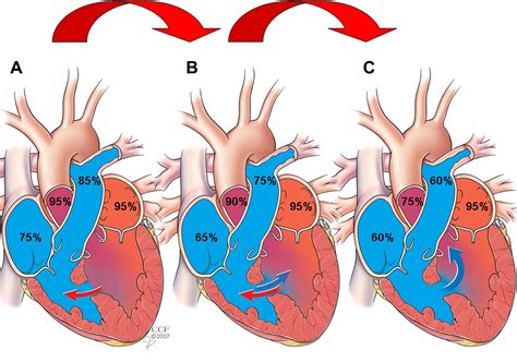 Congenital Heart Disease And Pulmonary Hypertension Heart Failure Clinics