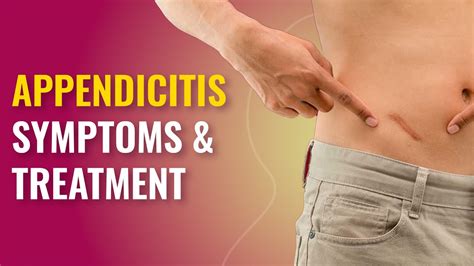 Appendicitis Symptoms And Treatment Appendicitis Pain Appendix