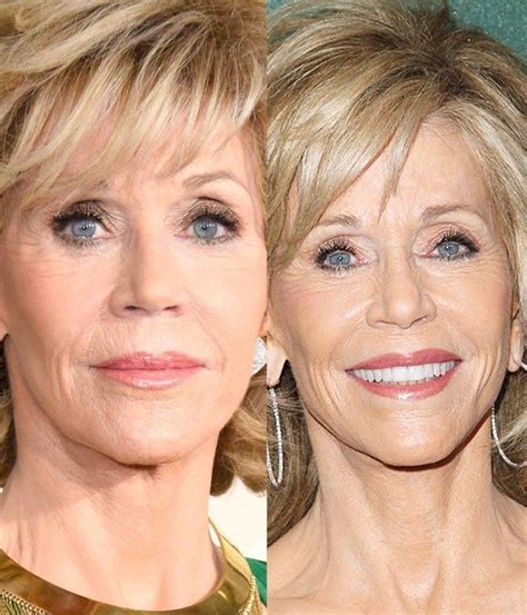Jane Fonda Plastic Surgery - No Aging Signs at 78 | Piel ...