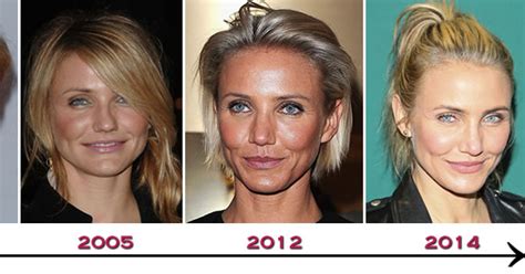 Cameron Diaz Plastic Surgery Before And After Kim Zolciak Plastic Surgery