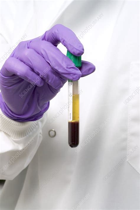 Centrifuged Blood Stock Image M5300530 Science Photo Library