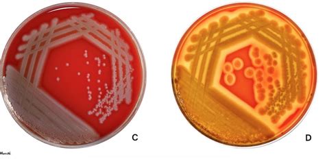 Agar Plates The Microbial Menagerie