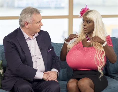 Who Is Martina Big Woman With S Boobs Was Born White But Used Tanning Injections And Now