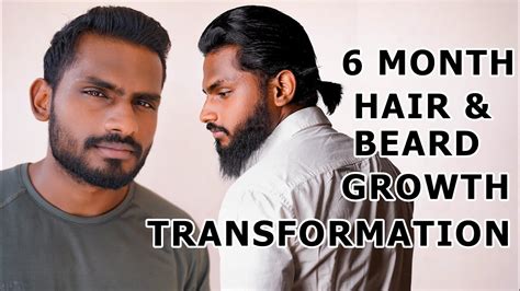Details 64 6 Month Hair Growth Best Ineteachers