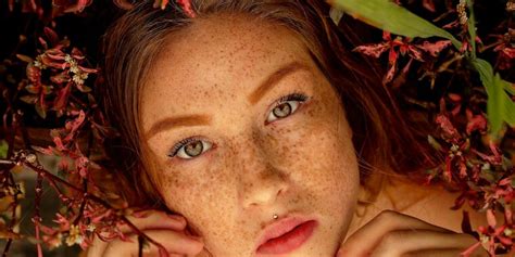 Join The A Moment With Freckles Photo Contest And Win Apple Watch