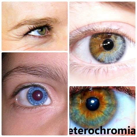 Heterochromia Iridum—people With Two Different Colored Eyes Owlcation