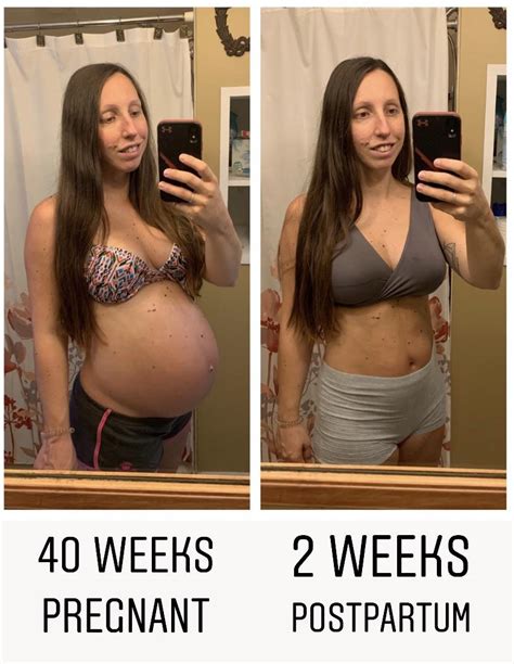 Before And After Baby Bump R Babybumps