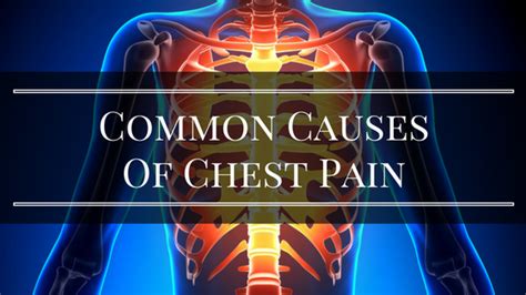 Common Causes Of Chest Pain Medi Station Urgent Care Miami Shores