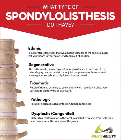 What Are Common Symptoms And Causes Of Spondylolisthesis