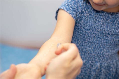 Allergy Testing For Children