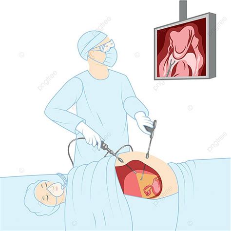 Minimallyinvasive Laparoscopy Surgery Doctor Performing Keyhole Procedure On Female And Male