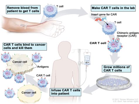 Stock screener for investors and traders, financial visualizations. The Successes and Challenges of CAR T-cell Therapy - ThermoGenesis Holdings, Inc.