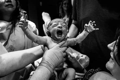 Breathtaking And Unforgettable Birth Photos