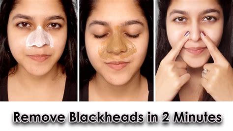 How To Remove Blackheads And Whiteheads From Face And Nose Permanently