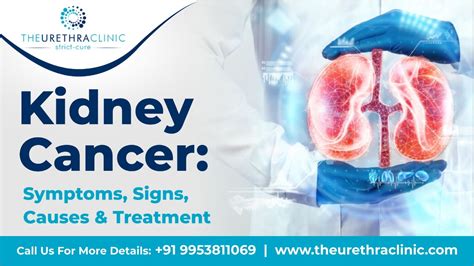 Kidney Cancer Symptoms Signs Causes And Treatment The Urethra Clinic