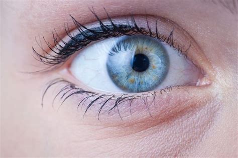 Do You Have Dark Spots In The Coloured Sections Of Your Eyes Vision