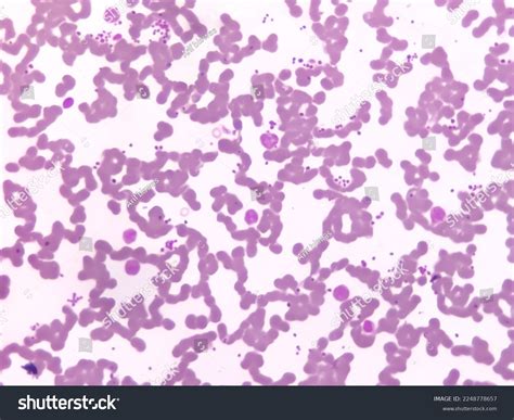 383 Neutrophilic Myelocyte Images Stock Photos And Vectors Shutterstock