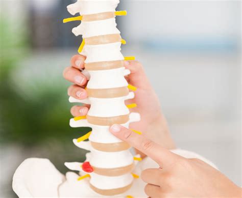 Chiropractic Biophysics Bethesda Spine And Posture Dc Metro Area