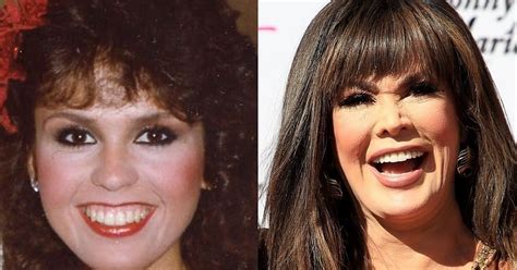 Marie Osmond Without Makeup Look Plastic Surgery Before And After