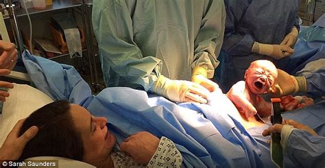 Natural Caesarean Allows Baby Babe To Crawl From His Mother S Stomach Daily Mail Online