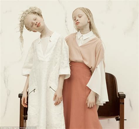 Albino Twins From São Paulo Become Models Daily Mail Online
