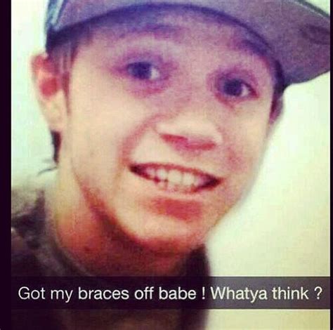 They Are Offim Gonna Miss Nialls Crooked Teeth And His Braces But Since Hes Happy So Am I