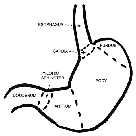 Figure Diagram Of The Stomach Illustrating Statpearls Ncbi