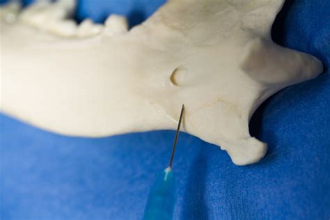 Nerve Blocks For Oral Surgery In Dogs Clinicians Brief