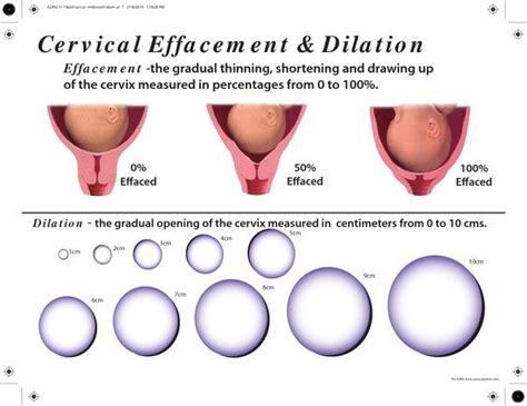 Dilation And Effacement Labor Doula Labor Delivery Nursing Doula Business Stages Of Labor