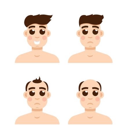 Best Thinning Hair Illustrations Royalty Free Vector Graphics And Clip Art Istock