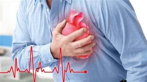 Choroba niedokrwienna serca zalecenia profilaktyczne według NFZ