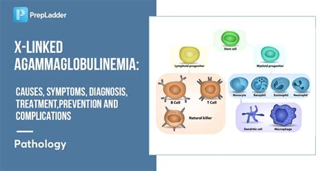 X Linked Agammaglobulinemia Causes Symptoms Diagnosis Treatment Prevention And Complications