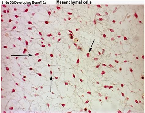 間葉(Mesenchyme) - 小小整理網站 Smallcollation