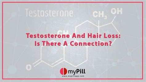 Testosterone And Hair Loss Is There A Connection