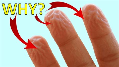 Why Does Your Skin Fingers Hands Feet Wrinkle Or Get Pruney In Water Youtube
