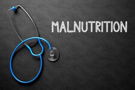 Malnutrition Infographic