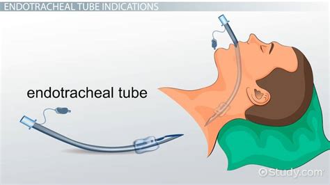 Endotracheal Tube In Patient