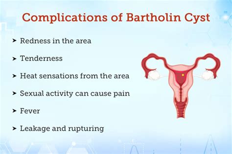 Bartholin Abscess Treatment Procedure Cost Recovery Side Effects