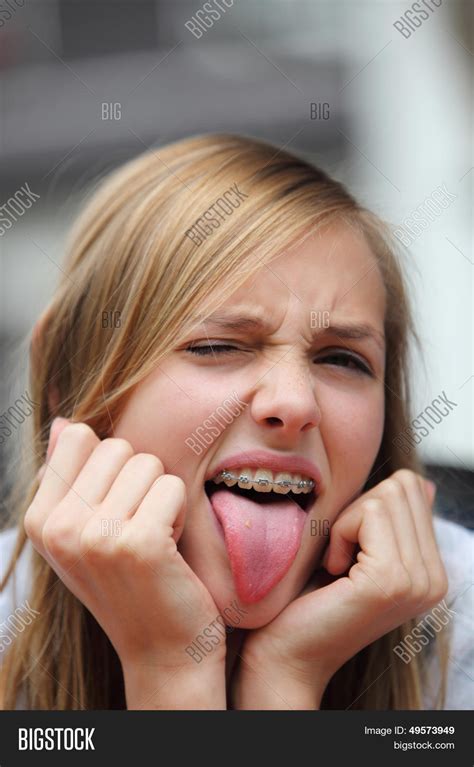 Yong Girl Braces Sticking Out Her Image And Photo Bigstock