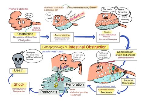 With quick care, treatment usually works well. Acute intestinal obstruction: Pathophysiology - Creative ...