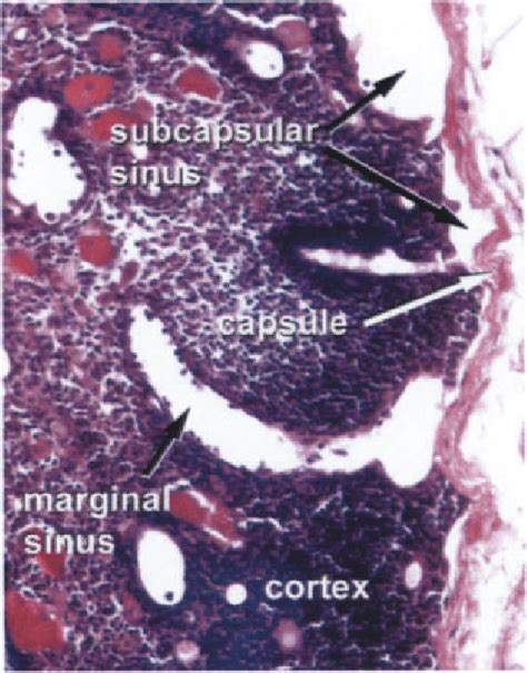 Sinuses Of The Lymph Node Cortex Underlying The Capsule Is A Sinus