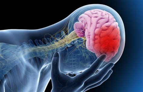 ¿qué Es La Hipoxia Cerebral Formato Siete