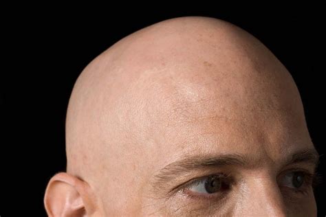 Is There An Evolutionary Benefit To Being Bald New Scientist