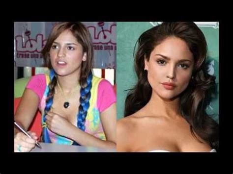 Eiza Gonzalez Before And After Plastic Surgery Images